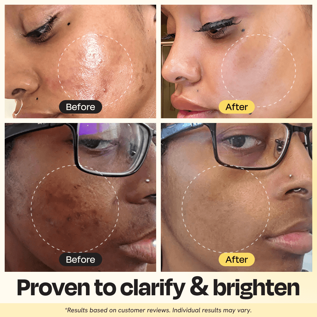 Vitamin C Clay Mask | Brightening & Clarifying Face Mask with Turmeric (regular size)