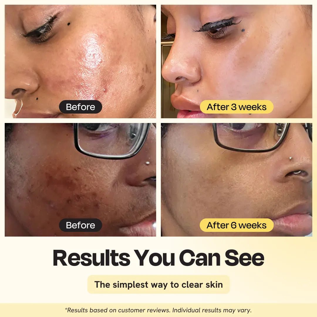 Jumbo Vitamin C Clay Mask | Brightening & Clarifying Face Mask with Turmeric