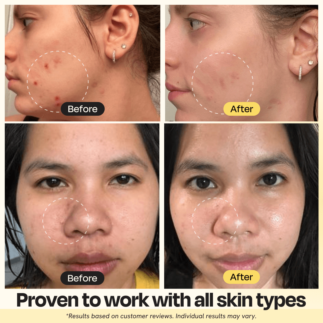 Vitamin C Clay Mask | Brightening & Clarifying Face Mask with Turmeric (regular size)